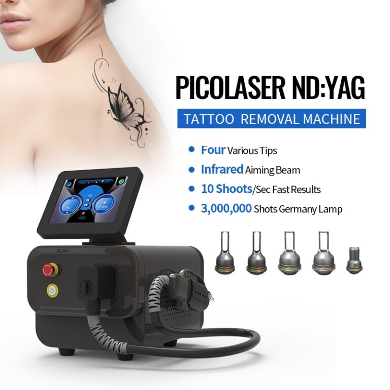 nd yag laser pigment removal machine