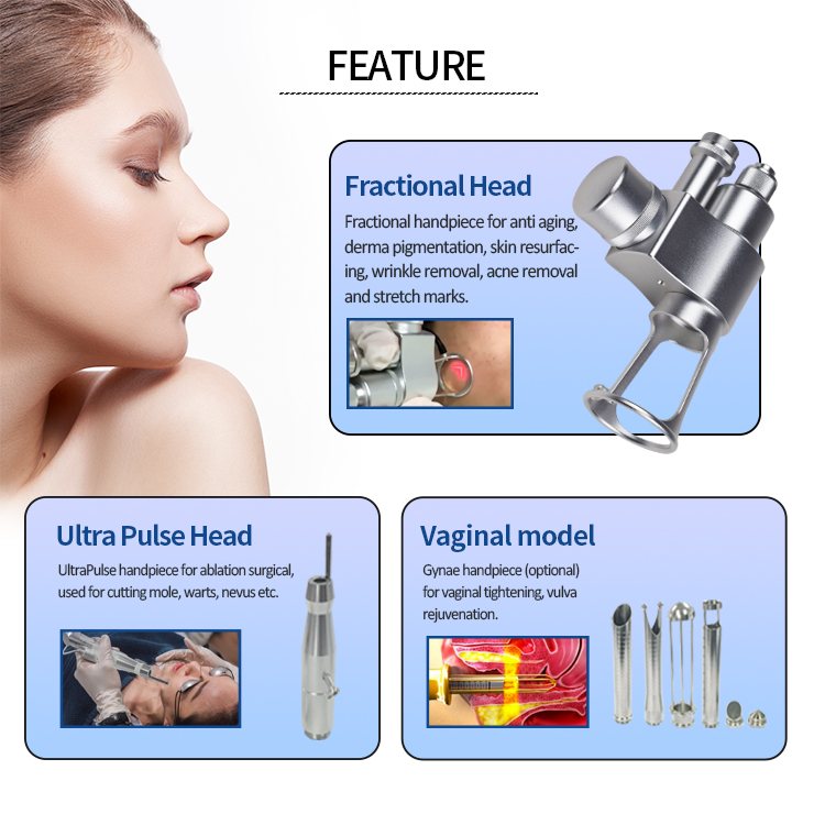 KES laser’s tailored CO₂ fractional systems