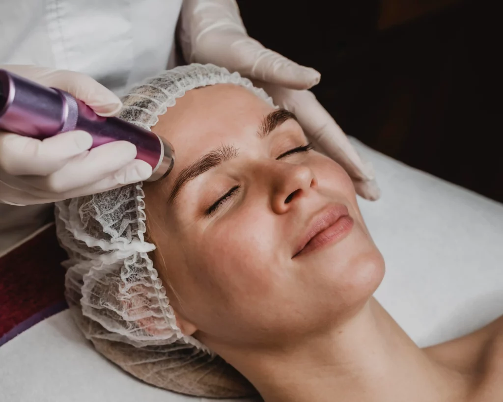 What Should Patients Expect After CO₂ Fractional Laser Treatment