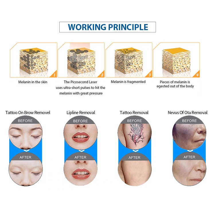 MED-810A-5 working principal