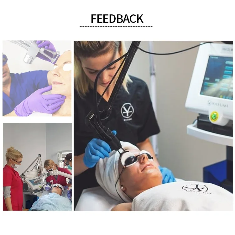 Fractional CO2 Laser Machine-4