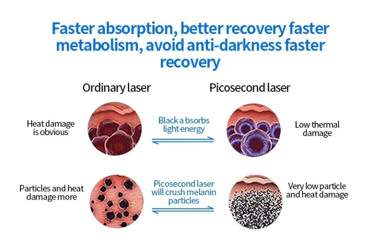 Picosecond vs Q-Switched Laser for Tattoo Removal Which Is Best for Clinics in 2026
