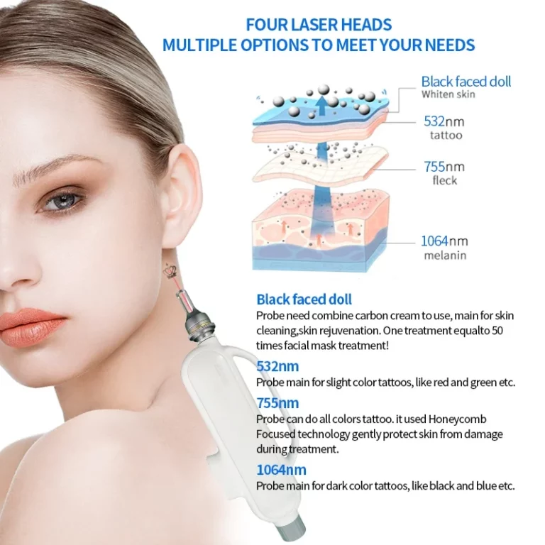 Tattoo Removal Laser Wavelengths by Ink Color and Skin Type