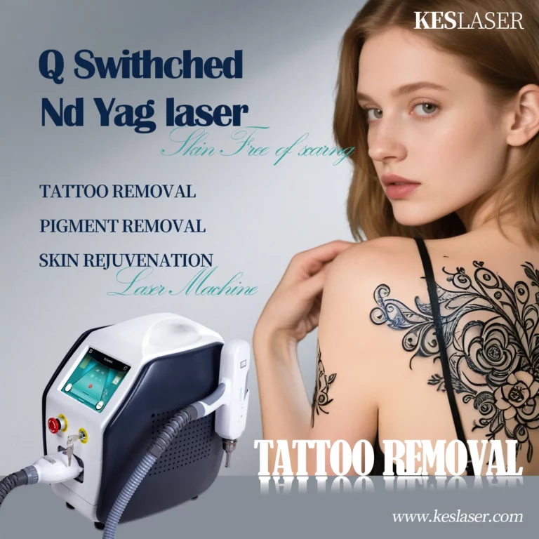 How to Compare Tattoo Removal Laser Manufacturers